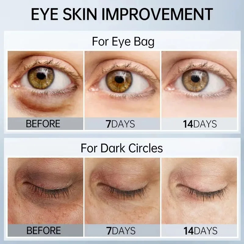 Eye Serum Wrinkle Remover